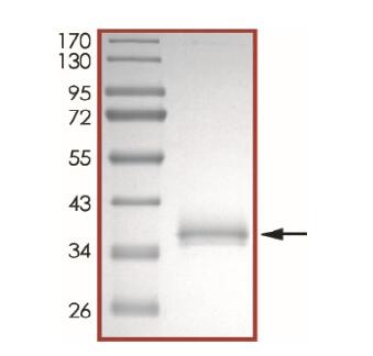 The purity of 2019-nCoV Spike protein S1 subunit, RBD (L452Q, F490S) was determined to be >90% by densitometry